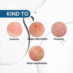 Safrin Skin Care image showing skin concerns: eczema, atopic dermatitis, psoriasis, sensitivities.