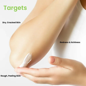 Applying moisturizer to elbow for dry, cracked, rough skin, redness and itchiness, Safrin Skin Care