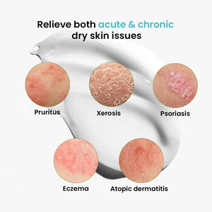 Graphic showing skin issues pruritus, xerosis, psoriasis, eczema, atopic dermatitis with cream background