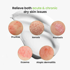 Safrin Skin Care image showing relief for dry skin issues like pruritus, xerosis, psoriasis, eczema, and atopic dermatitis with a cream smear background.