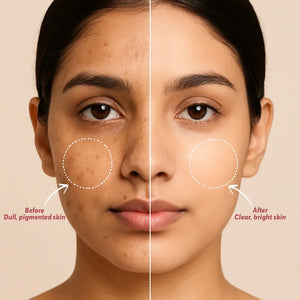 Before and after Safrin Skin Care: dull pigmented skin vs clear bright complexion.