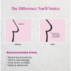 BustyDerm before and after diagram showing skin tightening results; recommended areas listed below.