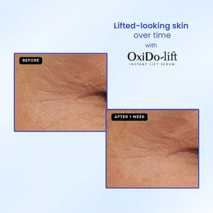 Before and after comparison of skin using Safrin OxiDo-lift serum showing reduced wrinkles.