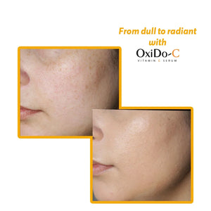 Before and after close-up of face showing results of OxiDo-C Vitamin C Serum by Safrin Skin Care