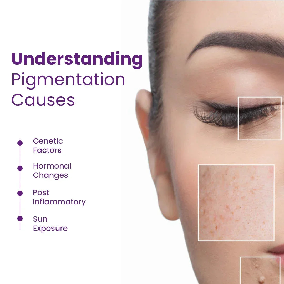 Close-up of woman's face showing skin pigmentation issues, with text on causes like genetics, hormonal changes, inflammation, and sun exposure, related to Safrin Skin Care solutions.