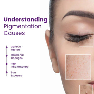 Close-up of woman's face showing skin pigmentation issues, with text on causes like genetics, hormonal changes, inflammation, and sun exposure, related to Safrin Skin Care solutions.