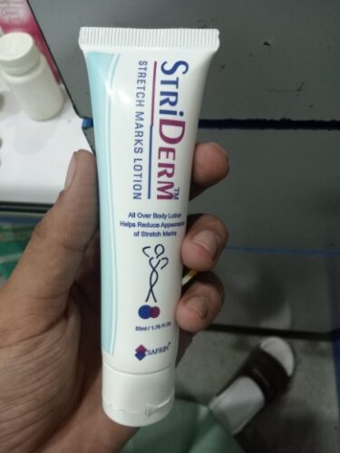 STRIDERM Stretch Marks Removing Lotion 50ml photo review